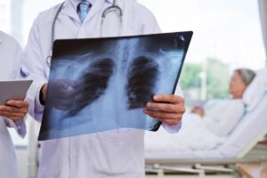 How Our Personal Injury Attorneys Can Help You Fight for Compensation for Your Chest Injuries
