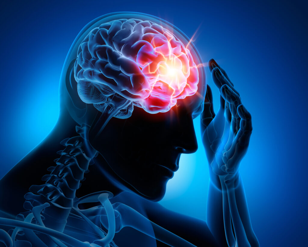 Is Cerebral Palsy a Result of Medical Malpractice?