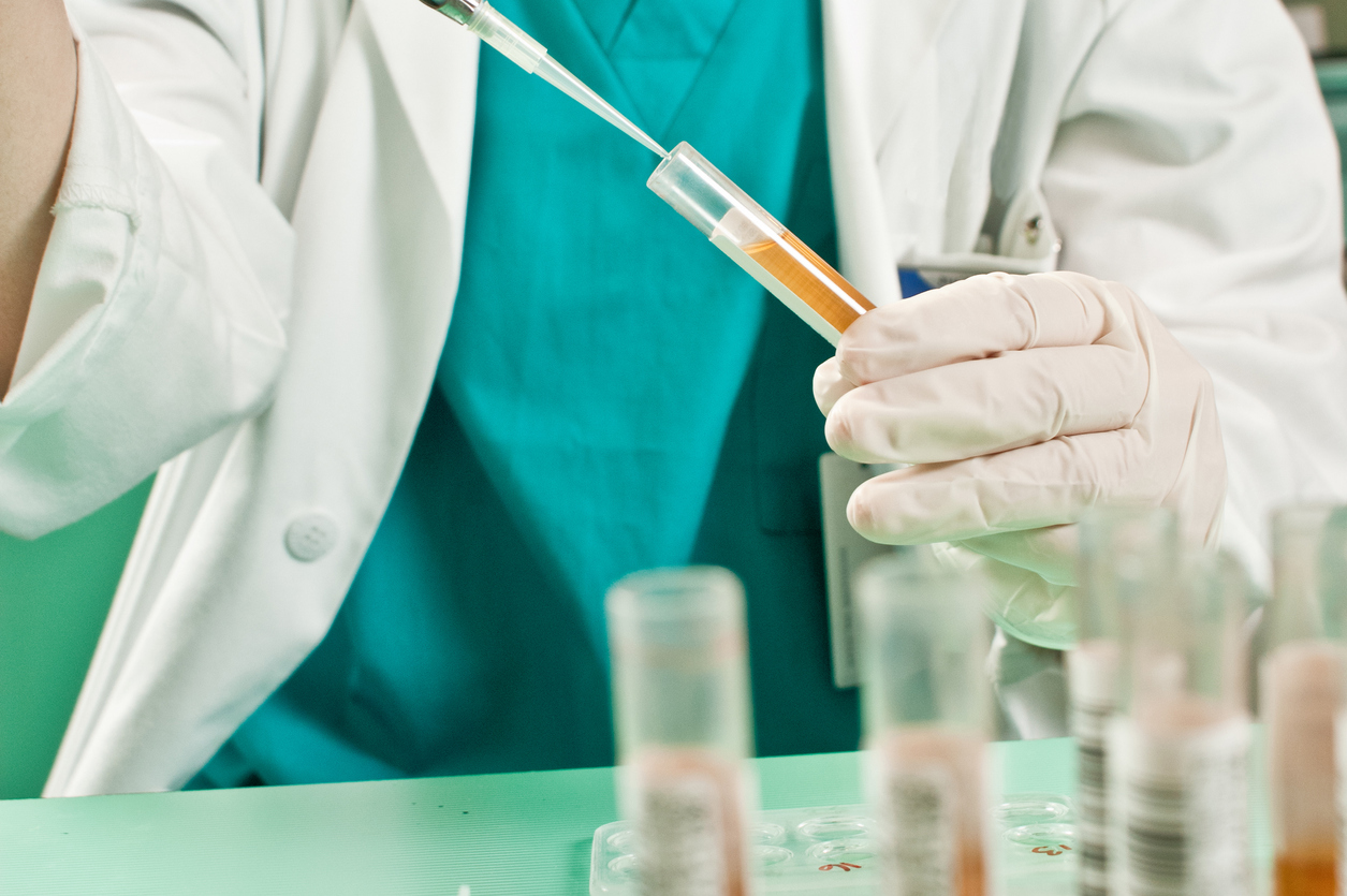 Refusing a Drug Test After a Workplace Accident