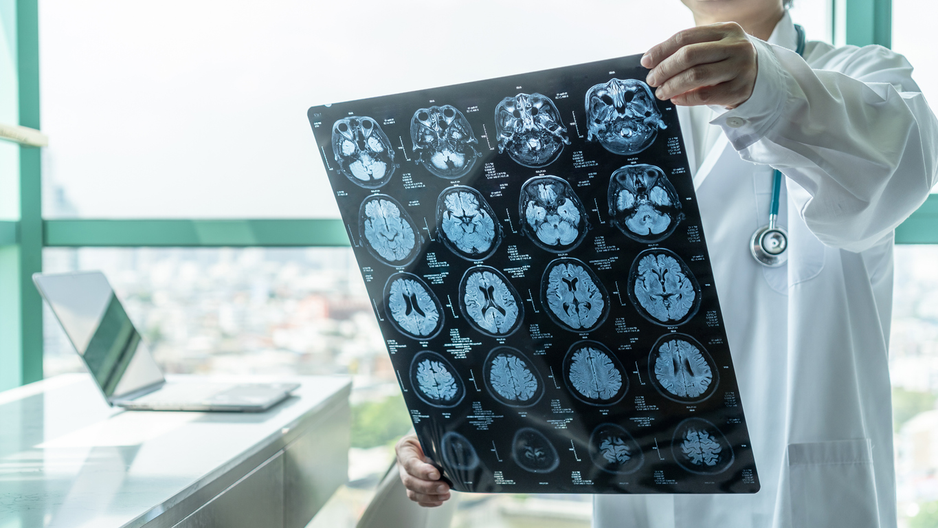 What Are the Causes and Effects of Brain-Stem Injuries?
