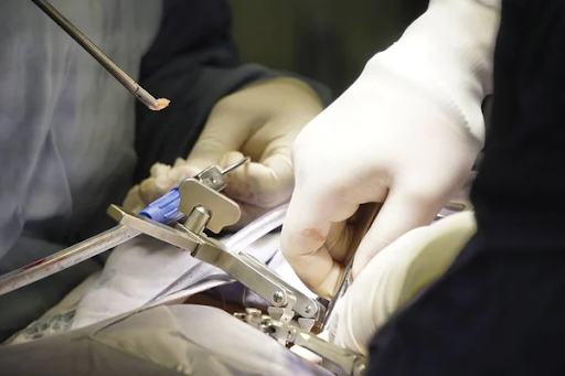 A close-up of defective medical devices.