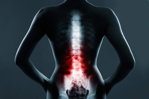 An X-ray image of a spine with red highlights, representing spinal cord injuries.